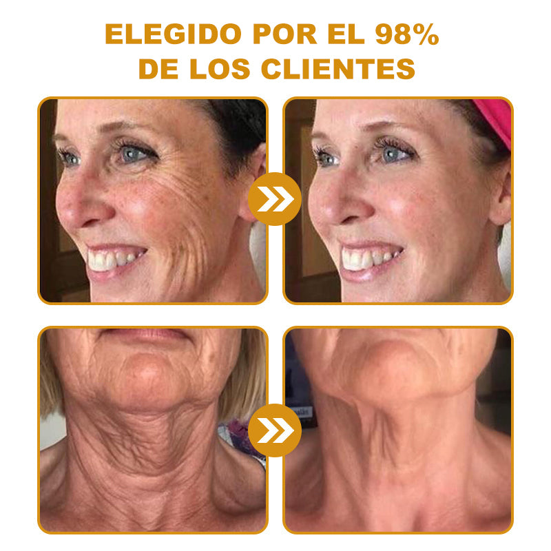 🔥 Último día de la oferta: 70% de descuento – Crema antiarrugas con veneno de abeja y efecto bótox Purelora®