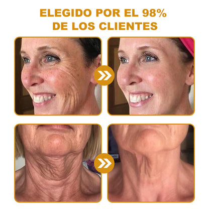 🔥 Último día de la oferta: 70% de descuento – Crema antiarrugas con veneno de abeja y efecto bótox Purelora®