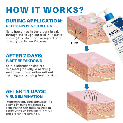 Purelora® NanoLipo HPV Genital Warts Eraser Cream