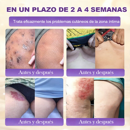 Fabricada y enviada desde EE. UU. 🍁 Crema reparadora de la piel Purelora® con biotina (fórmula 10 en 1) — Último día de oferta: 75 % de descuento.