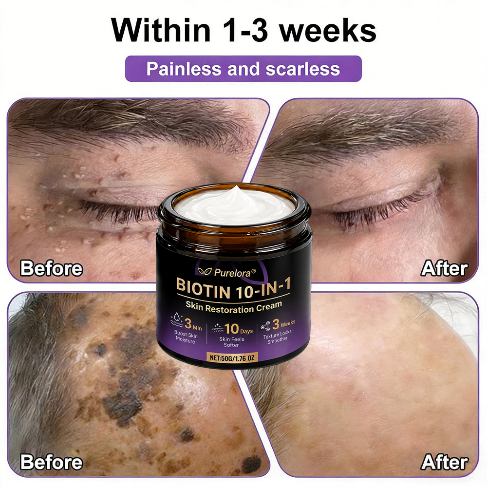 Fabricada y enviada desde EE. UU. 🍁 Crema reparadora de la piel Purelora® con biotina (fórmula 10 en 1) — Último día de oferta: 75 % de descuento.（副本）