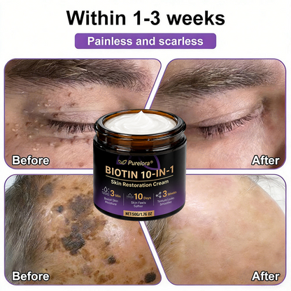 Fabricada y enviada desde EE. UU. 🍁 Crema reparadora de la piel Purelora® con biotina (fórmula 10 en 1) — Último día de oferta: 75 % de descuento.（副本）