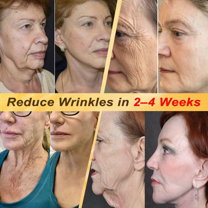 ✨🐝𝐇𝐈𝐒𝐊𝐈𝐍® 𝐌𝐮𝐥𝐭𝐢-𝐂𝐨𝐧𝐜𝐞𝐫𝐧 𝐒𝐤𝐢𝐧 𝐑𝐞𝐩𝐚𝐢𝐫 𝐂𝐫𝐞𝐚𝐦 (𝐎𝐧𝐞 𝐩𝐨𝐰𝐞𝐫𝐟𝐮𝐥 𝐜𝐫𝐞𝐚𝐦 𝐭𝐨 𝐫𝐞𝐩𝐚𝐢𝐫 𝐢𝐧𝐟𝐥𝐚𝐦𝐦𝐚𝐭𝐢𝐨𝐧, 𝐝𝐫𝐲𝐧𝐞𝐬𝐬, 𝐚𝐠𝐢𝐧𝐠, 𝐩𝐢𝐠𝐦𝐞𝐧𝐭𝐚𝐭𝐢𝐨𝐧, 𝐚𝐧𝐝 𝐯𝐢𝐬𝐢𝐛𝐥𝐞 𝐬𝐤𝐢𝐧 𝐝𝐚𝐦𝐚𝐠𝐞.)