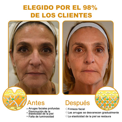 🔥 Último día de la oferta: 70% de descuento – Crema antiarrugas con veneno de abeja y efecto bótox Purelora®