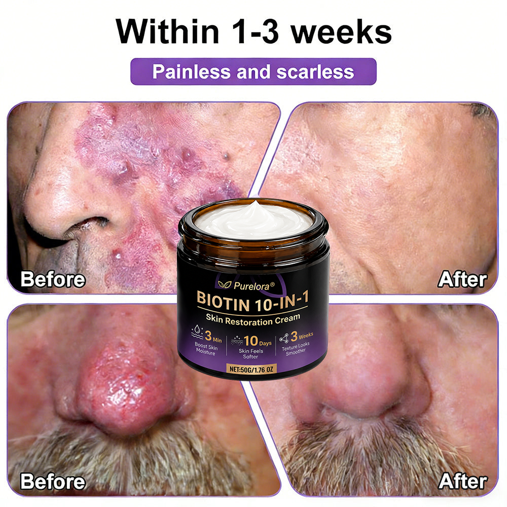 Fabricada y enviada desde EE. UU. 🍁 Crema reparadora de la piel Purelora® con biotina (fórmula 10 en 1) — Último día de oferta: 75 % de descuento.（副本）