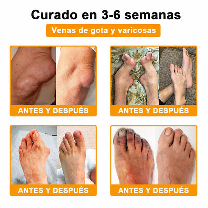 Crema Purelora® con toxina botulínica y veneno de abeja para el alivio del dolor y la regeneración ósea