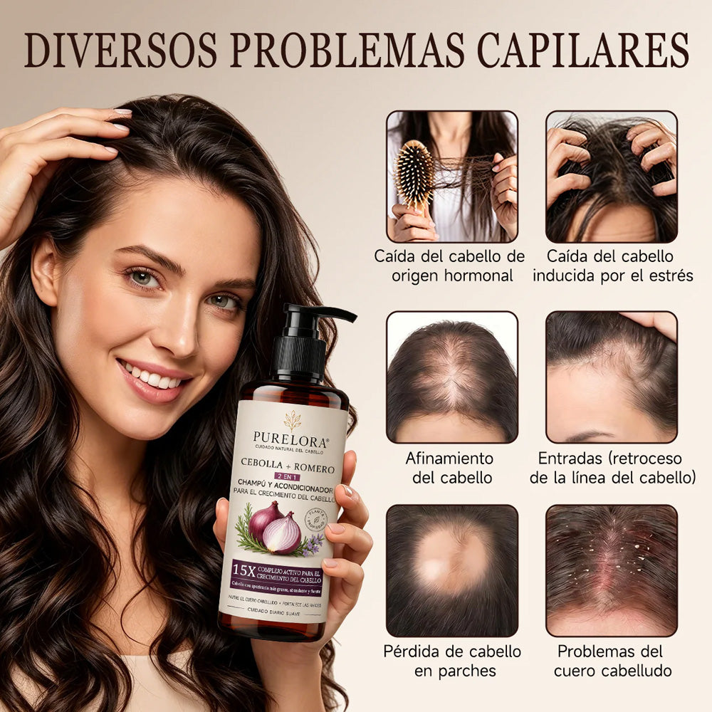 🌿👨‍⚕️ Tienda oficial en EE. UU. 🇺🇸 | 🔥 Champú y acondicionador 2 en 1 PURELORA® de cebolla y romero con complejo activo 15X para el crecimiento capilar: para un cabello con apariencia más gruesa, abundante y fuerte.