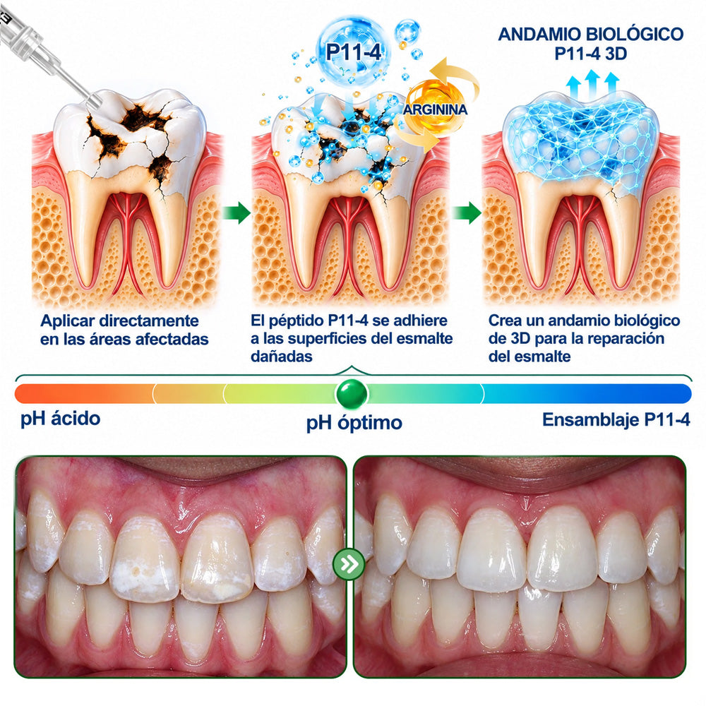 👨‍⚕️🦷✨𝐏𝐔𝐑𝐄𝐋𝐎𝐑𝐀® Gel MicroFill Pept11 Inverso de Cavidad