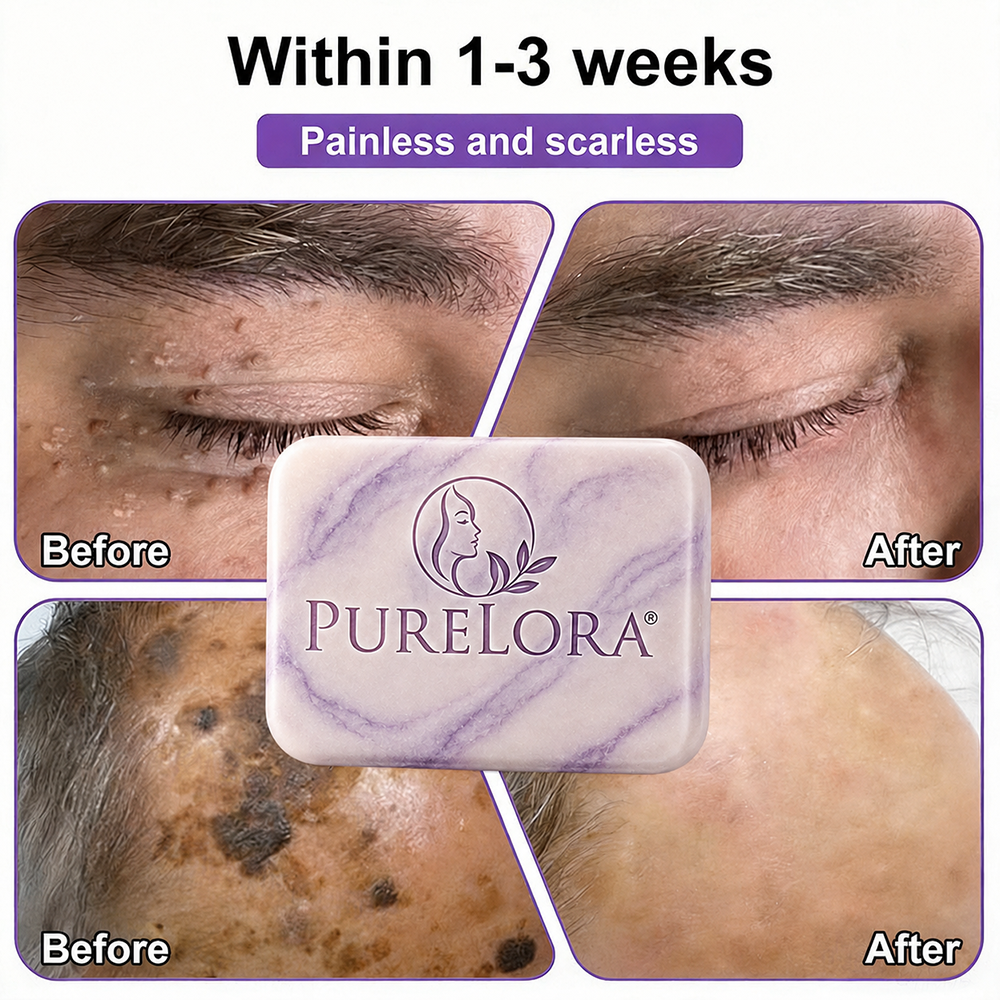 PURELORA® Yoni & Wart Relief Bar Soap | pH-Balanced with Boric Acid & Tea Tree Oil | 2-in-1 Intimate Care & Skin Clarifying Bar | Women's Daily Wash