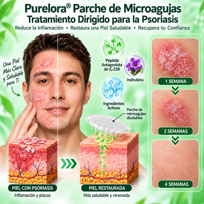 𝐏𝐔𝐑𝐄𝐋𝐎𝐑𝐀® 👩‍⚕️👩‍⚕️ Parche de nanomicroagujas 10 en 1 con péptido antagonista de IL-23R e indirubina (ayuda a reducir el enrojecimiento visible y la descamación, calma la sequedad y la picazón, y favorece el refuerzo y la reparación de la barrera cutánea)