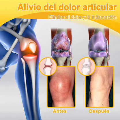 Crema Purelora® con toxina botulínica y veneno de abeja para el alivio del dolor y la regeneración ósea