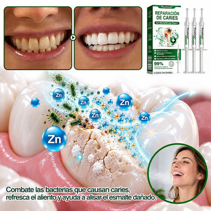 👨‍⚕️🦷✨𝐏𝐔𝐑𝐄𝐋𝐎𝐑𝐀® Gel MicroFill Pept11 Inverso de Cavidad