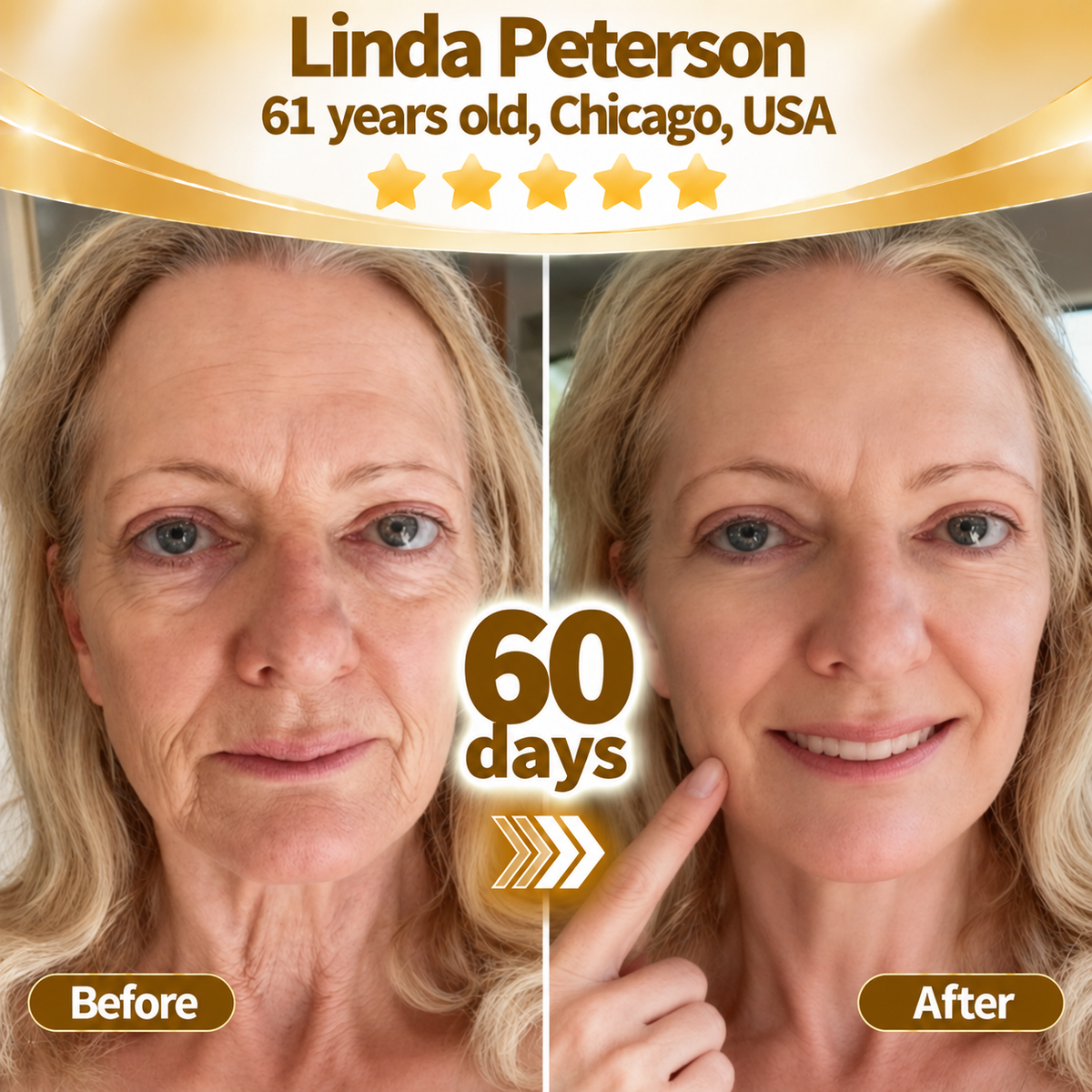 Purelora® Snake Venom Peptide Renewal Serum – Firming, Fine Lines & Visible Marks Care
